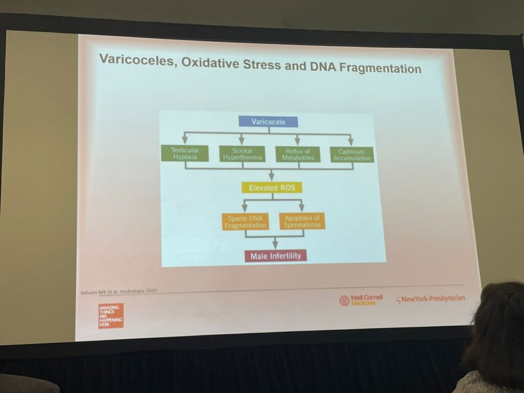 varicocele e infertilidade masculina