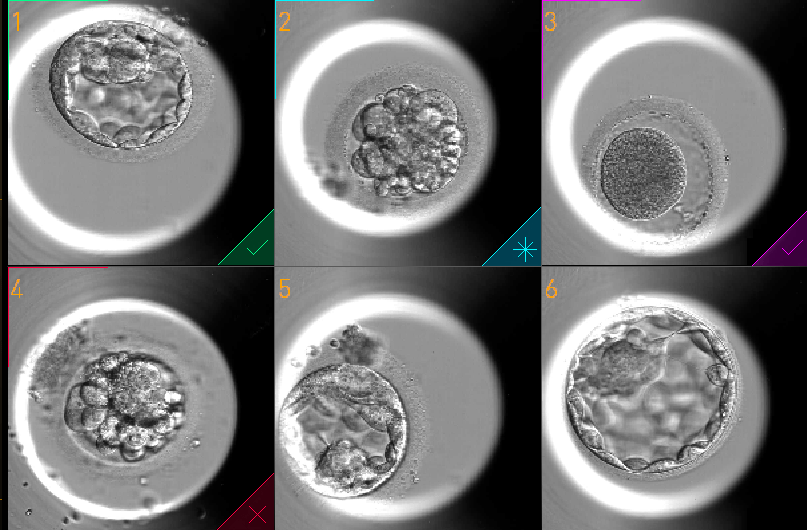 embryoscope time lapse