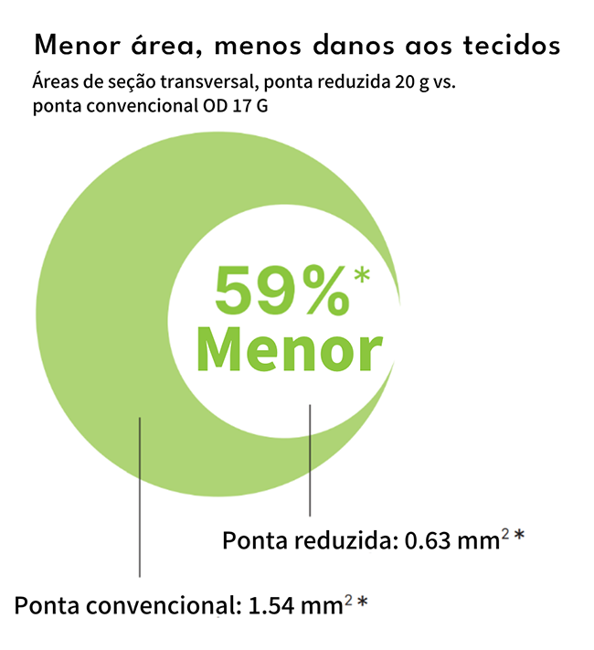 agulhas de punção para coleta de óvulos sense fazem menos dano e causam menos dor